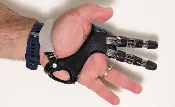 Wrist / Hand